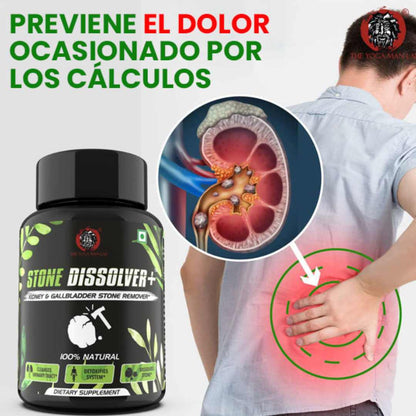 Stone Dissolver™ x 20 Cápsulas – Riñones Limpios y Sin Dolor 💧