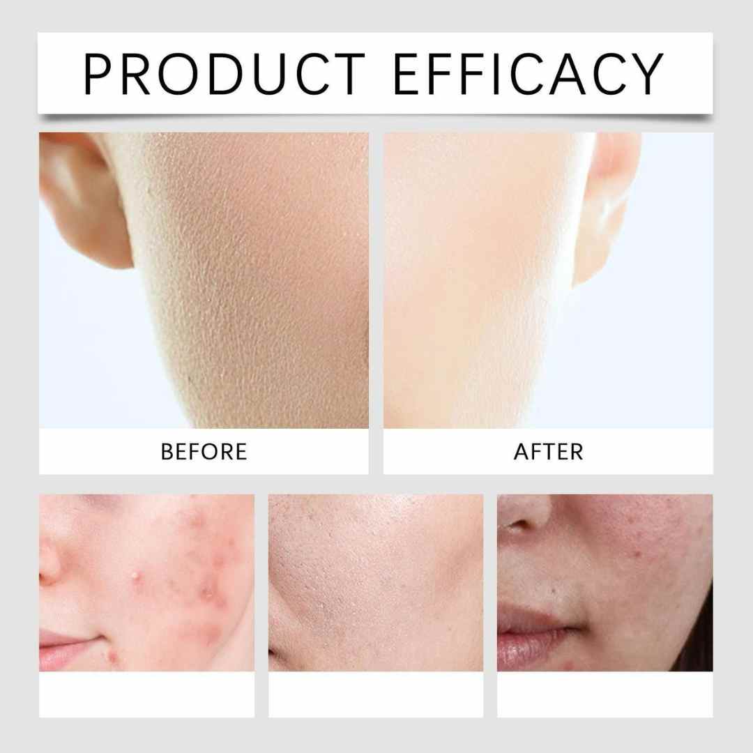 Dr. Althea 345 – Tu Piel Sin Manchas y sin acné