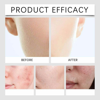 Dr. Althea 345 – Tu Piel Sin Manchas y sin acné