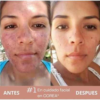 Dr. Althea 345 – Tu Piel Sin Manchas y sin acné