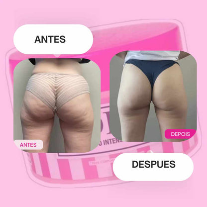 Crema Adeus 5 en 1 x 300g – Piel Firme y Sin Imperfecciones 💖