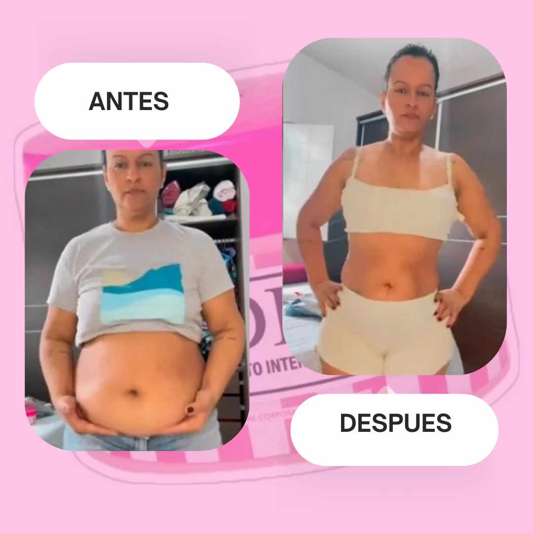 Crema Adeus 5 en 1 x 300g – Piel Firme y Sin Imperfecciones 💖