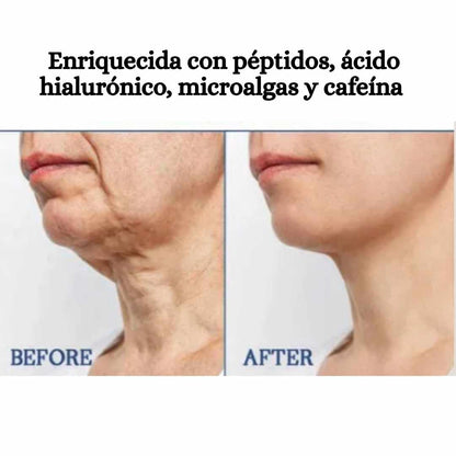 Crema Reafirmante HOYGI 240ml — Tecnología Coreana · 240ml